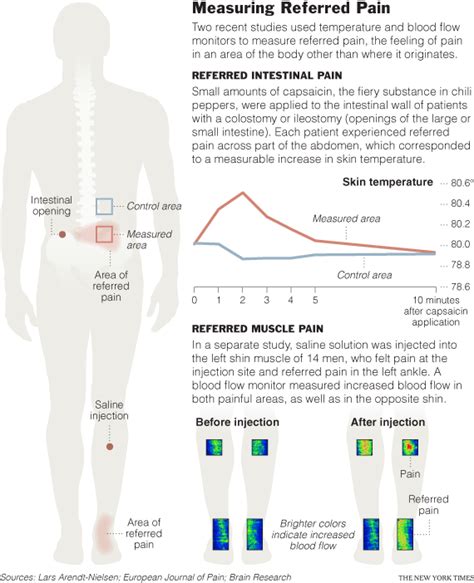 The New York Times Health Image Measuring Referred Pain