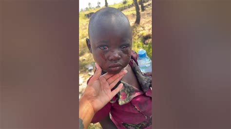 Outbreak Of Conjunctivitis Red Eye Disease In Uganda Three Cases Registered At The Orphanage