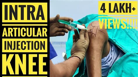 Painfree Intra Articular Injection Of Knee Youtube