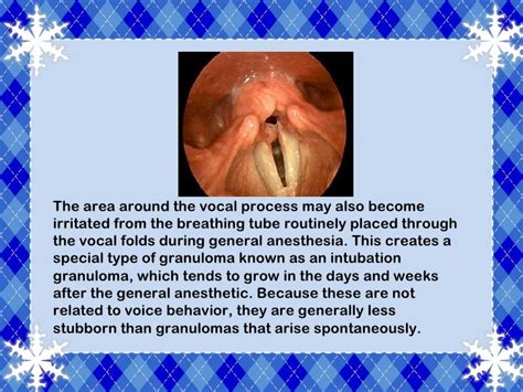Vocal Cord Granuloma