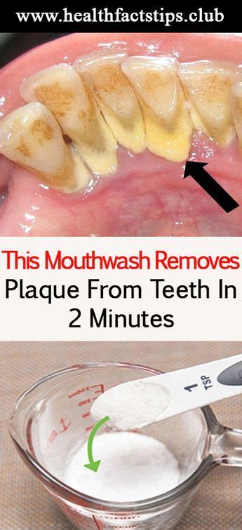 this mouthwash removes plaque from teeth in 2 minutes teeth health