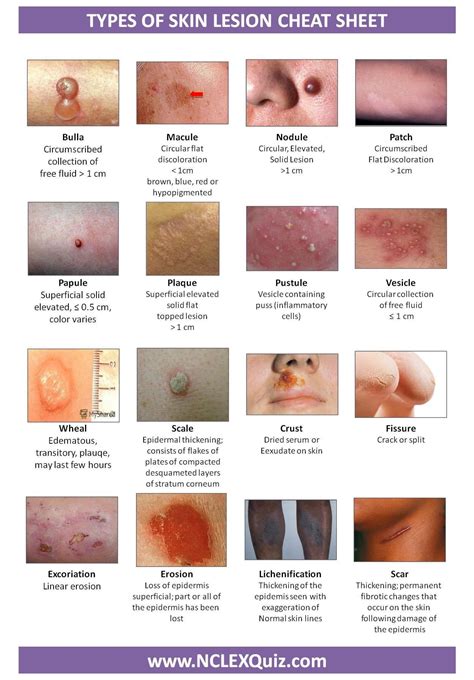 Hello Skin By หมอผิวหนัง Dermatologists Blog