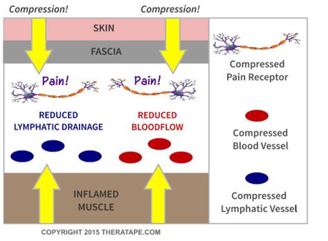 Kinesio tape, however, has polymer elastic strands woven through the cotton, so the tape is flexible and doesn't impede range of motion when it's applied. How Does Kinesiology Tape Work | Theratape.com