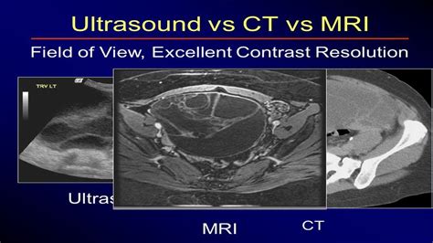 Mri Vs Ct Scan Vs Xray Vs Ultrasound The Best Porn Website