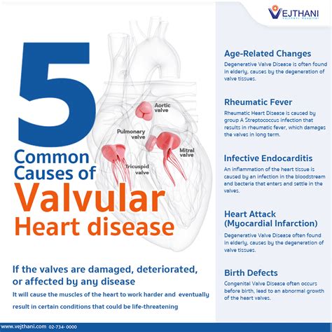 5 Common Causes Of Valvular Heart Disease Vejthani Hospital