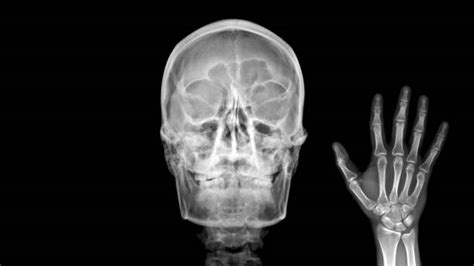 Funny X Ray Images Stock Photos Pictures And Royalty Free Images Istock