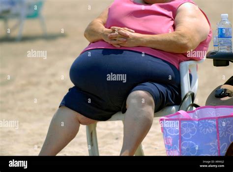 Very Fat Woman Sitting In A Chair On A Beach Stock Photo Alamy