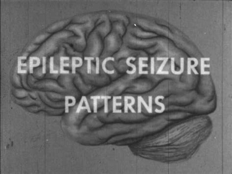 Epileptic Seizure Patterns · Indiana University Libraries Moving Image