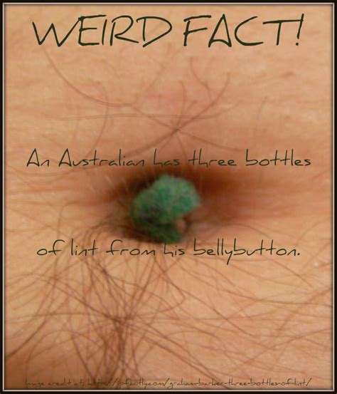 An Australian Has Three Bottles Of Lint From His Bellybutton Always