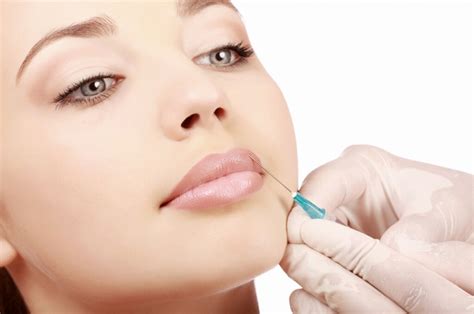 filler labbra più volume con acido ialuronico roba da donne