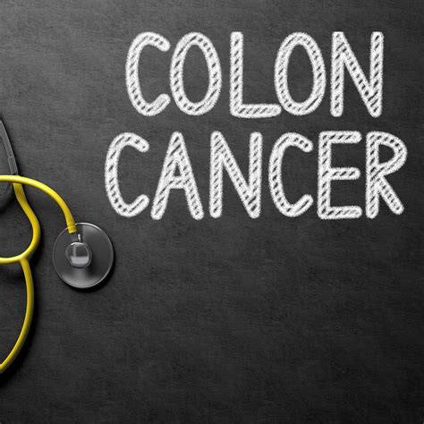 Top 10 Causes Of Colon Cancer Healthier Steps
