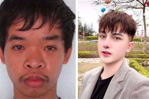 Vietnamese Man Gets Numerous Plastic Surgeries To Look Like A K Pop