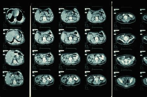 What Is A Ct Scan What The Test Detects And How It Works