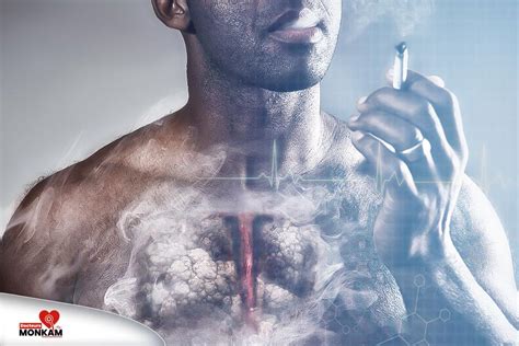 quelles sont les conséquences du tabagisme sur la santé docteurs monkam