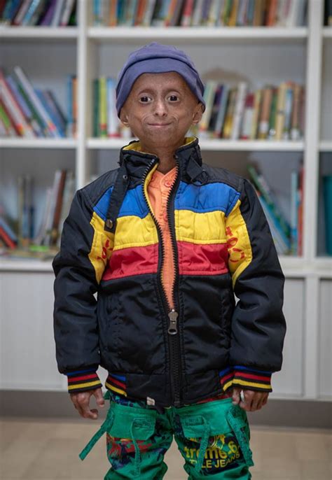 Children With Progeria Hold Out Messages Of Hope In Lockdown