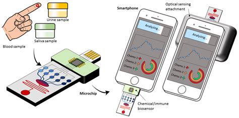 Microfluidic Point Of Care Diagnostic Devices For Global