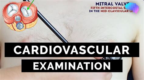 Cardiovascular Examination Osce Guide Ukmla Cpsa Youtube