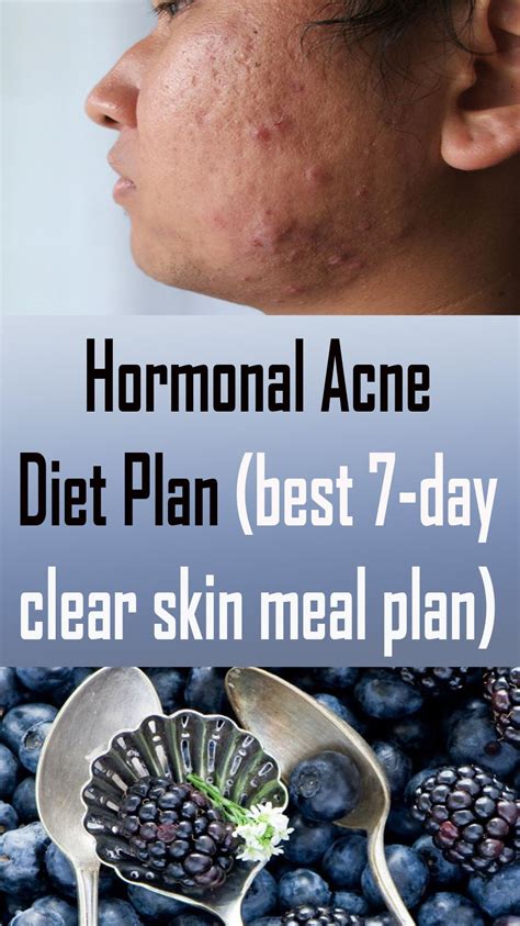 Hormonal Acne Diet Plan Best 7 Day Clear Skin Meal Plan Acne Diet