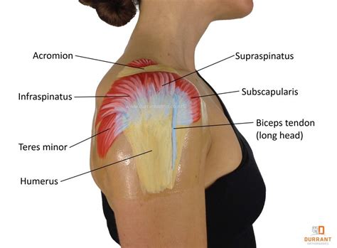 This diagram illustrates the interior of the right shoulder joint capsule as viewed from the side. Rotator Cuff Tears Part One - Traumatic Tears And Diagnosis