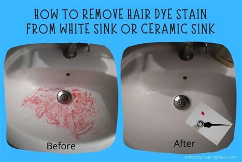 Top 48 Image How To Get Hair Dye Off Sink Thptnganamst Edu Vn