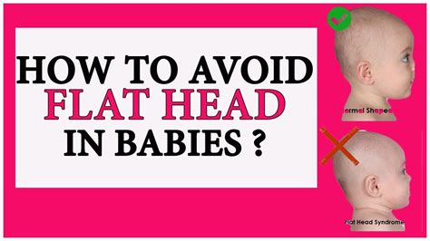 How To Avoid Flat Head In Babies कैसे रखें बच्चों का सिर गोल Youtube