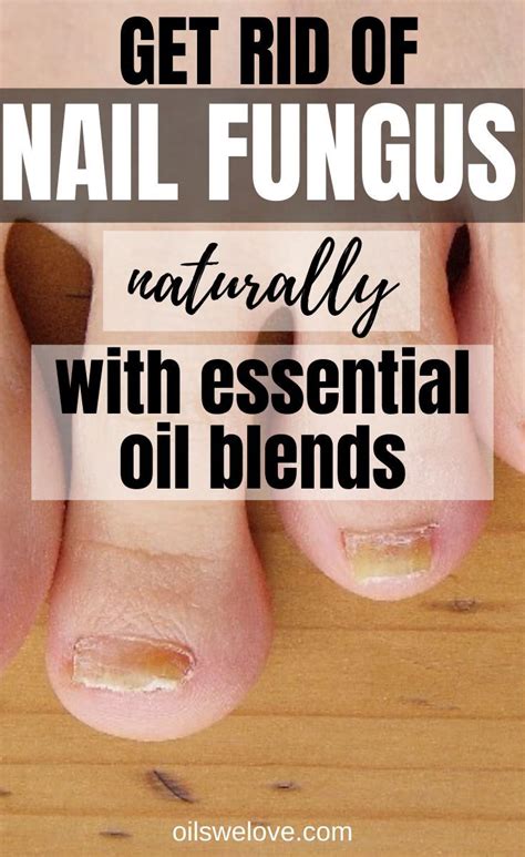 What Are The Best Essential Oils For Nail Fungus Nail Fungus
