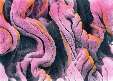 Coloured Sem Of Surface Of Vaginal Epithelium Photograph By Prof P