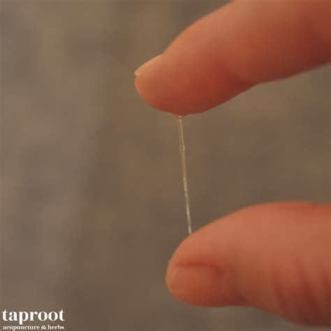 Cervical Mucus Fertility And Acupuncture