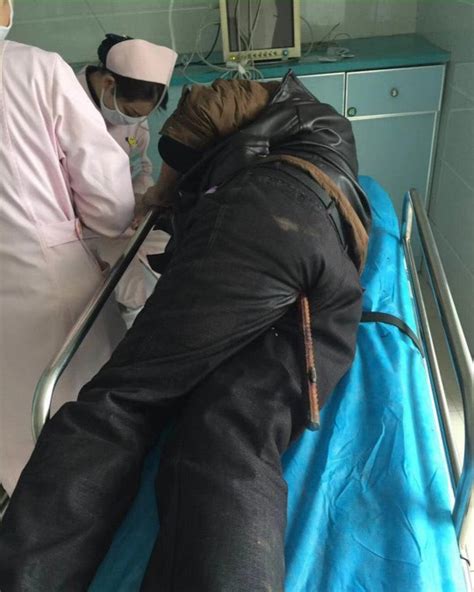 Chinese Worker Miraculously Survives Being Impaled By Rusty Steel Bar Metro News