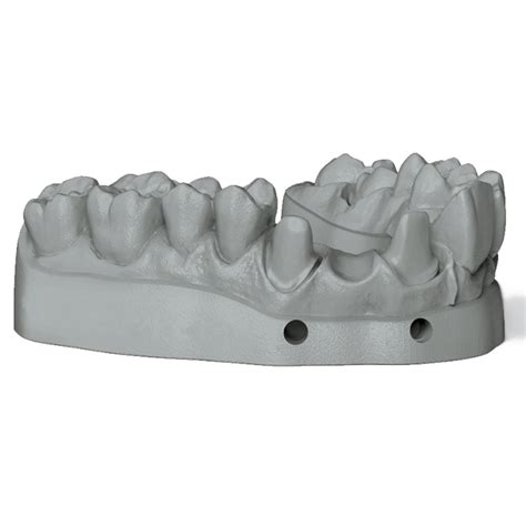 Nextdent Resin Fda Cleared Dental Resin Ultimate 3d Printing