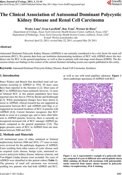 The Clinical Association Of Autosomal Dominant Polycystic Kidney