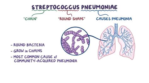 Streptococcus Pneumoniae Video Anatomy And Definition Osmosis