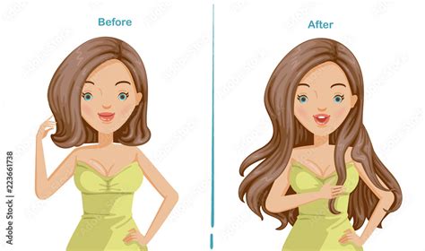 Before And After Clip Art