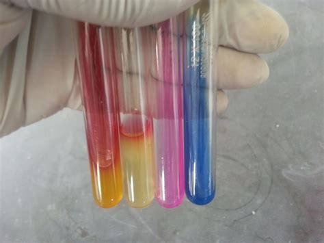 Biochemical Test Reaction Interpretation Of Gram Negative Bacterium Tsi