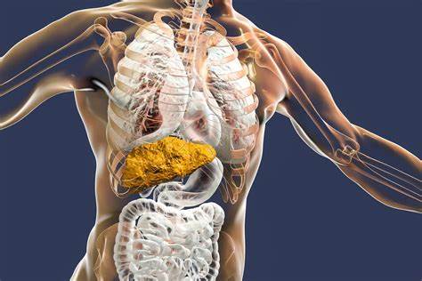 Неалкогольный жировой гепатоз диета Почему развивается цирроз печени: далеко не всегда проблема только в Почему развивается цирроз печени: далеко не всегда проблема только в Неалкогольный жировой гепатоз диета
