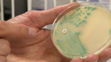 Warning Over Hospital Superbug Linked To 16 Deaths Bbc News