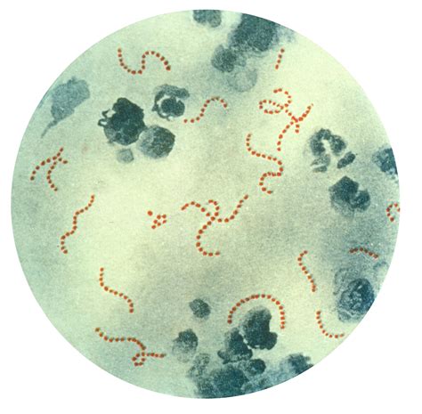 Filestreptococcus Pyogenes 01