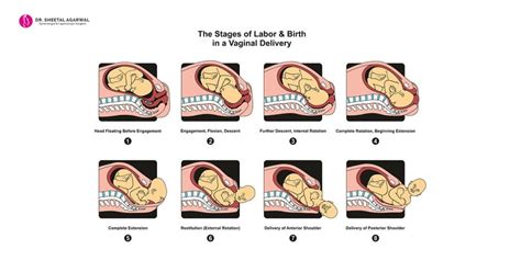 What Is A Normal Delivery 8 Tips To Ensure Having One Dr Sheetal