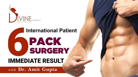 International Patient 6 Pack Surgery And Immediate After Surgery Result