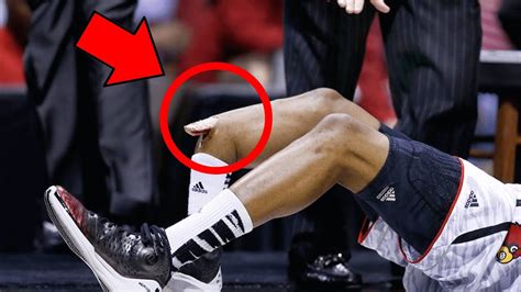 Nba Players Careers Being Cut Short Due To Horrific Injuries สรุป