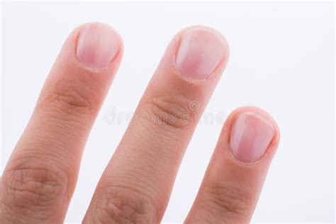 Hand Fingers And Fingernails On A White Background Stock Photo Image