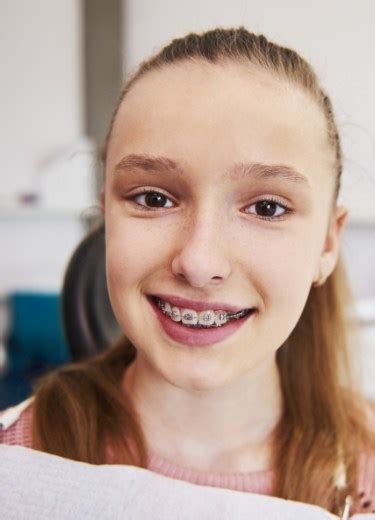 Traditional Braces Palm Harbor Fl Orthodontist Dr Alex Johnson