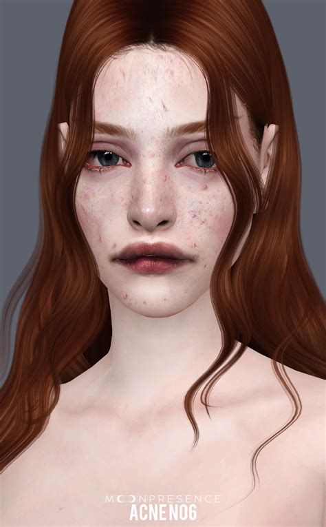 Sims 4 Cas The Sims Acne Skin Gender Poses Age 1930s Figure