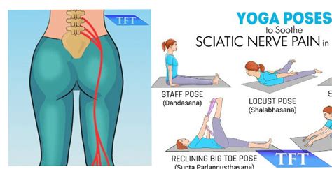 Tingling down the back of your leg? Yoga Poses to Soothe Sciatic Nerve Pain in 15 Minutes