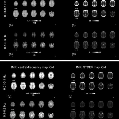 Resting‐state Functional Magnetic Resonance Imaging Rs‐fmri Frequency
