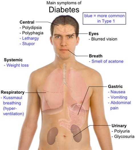 How Do You Go Into A Diabetic Coma Diabeteswalls