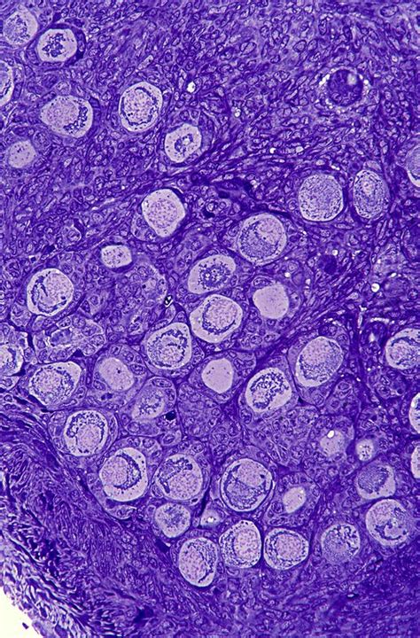 Ovarian Primordial Follicles Micrograph Stock Image C0160518