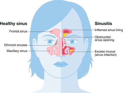 What Are The Sinuses Responsible For Maryland Ent