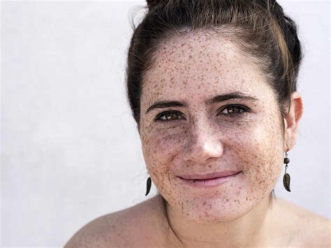 Pretty Girl With Freckles Smiling Stock Photo