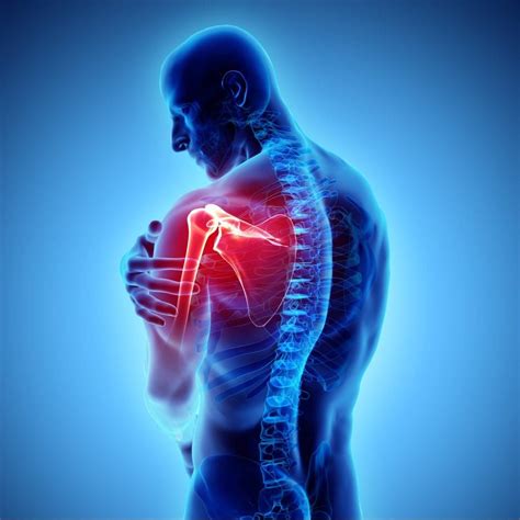 Shoulder Pain Management Shoulder Pain Causes And Treatment